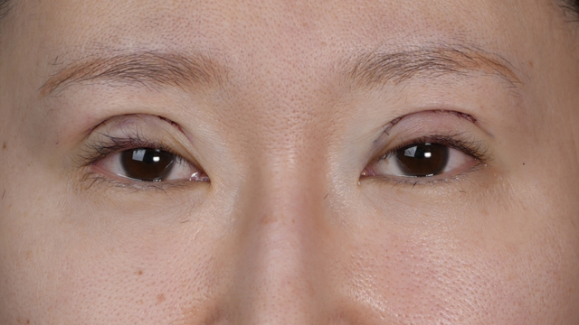 Postoperative Condition Part 1