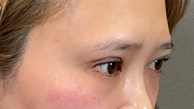 Postoperative Condition Part 1