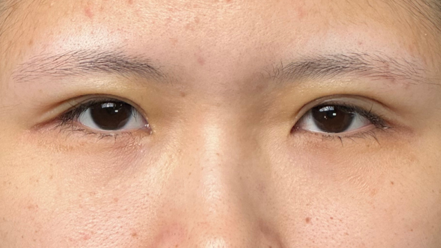 Postoperative Condition Part 1