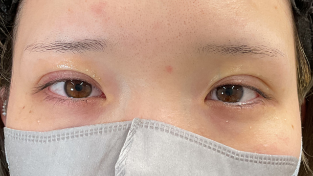 Postoperative Condition Part 1