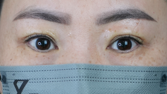 Postoperative Condition Part 1