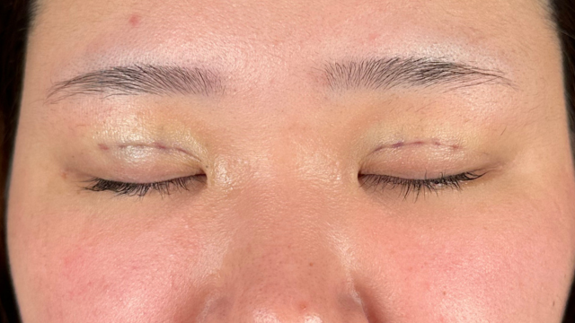 Postoperative Condition Part 1