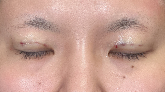 Postoperative Condition Part 1