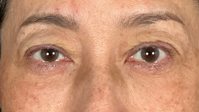 Postoperative Condition Part 1