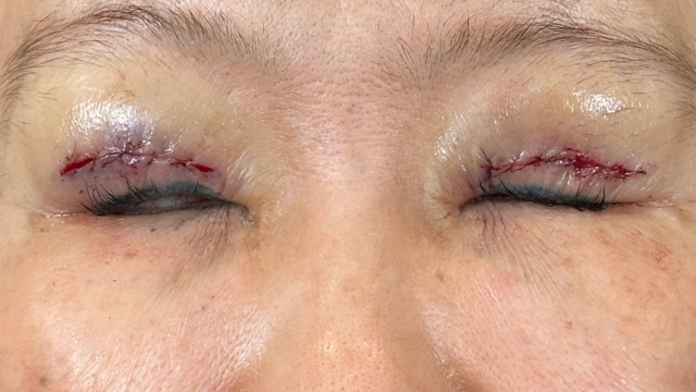 Postoperative Condition Part 1