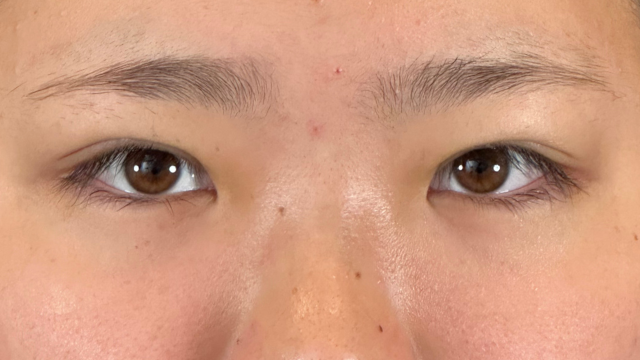 Postoperative Condition Part 1