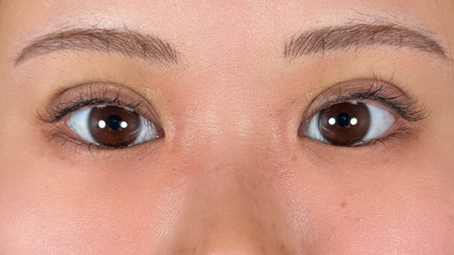 Postoperative Condition Part 1