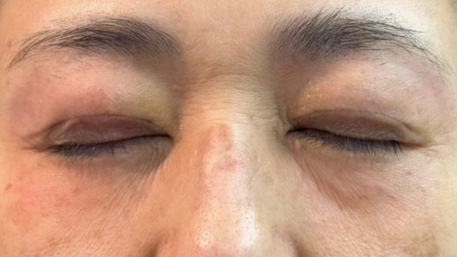 Postoperative Condition Part 1