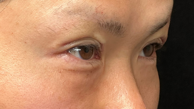 Postoperative Condition Part 1