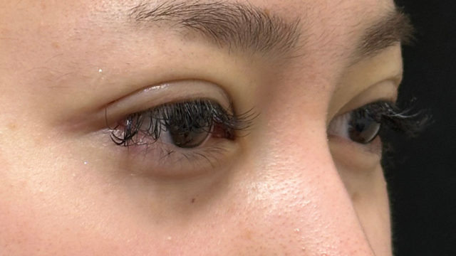 Postoperative Condition Part 1