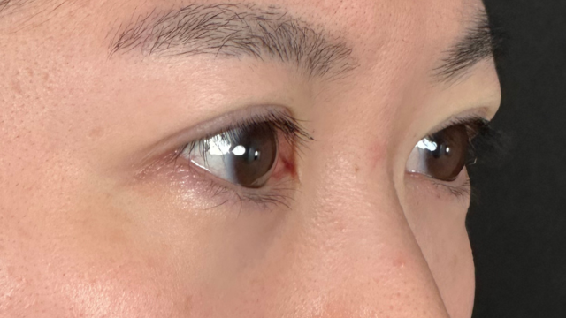 Postoperative Condition Part 1