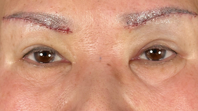 Postoperative Condition Part 1