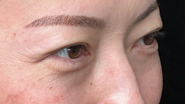 Postoperative Condition Part 1