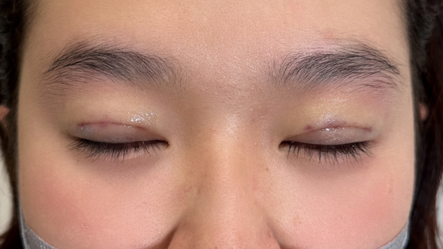 Postoperative Condition Part 1