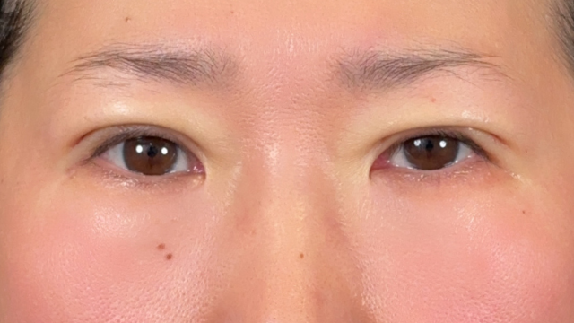 Postoperative Condition Part 1