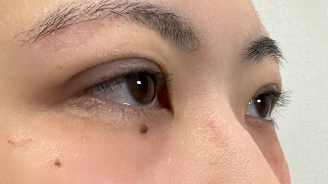 Postoperative Condition Part 1