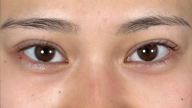 Postoperative Condition Part 1