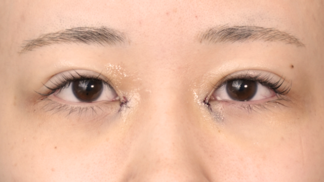 Postoperative Condition Part 1