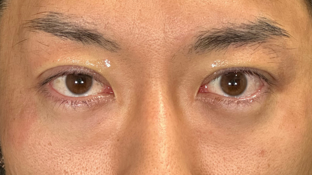 Postoperative Condition Part 1