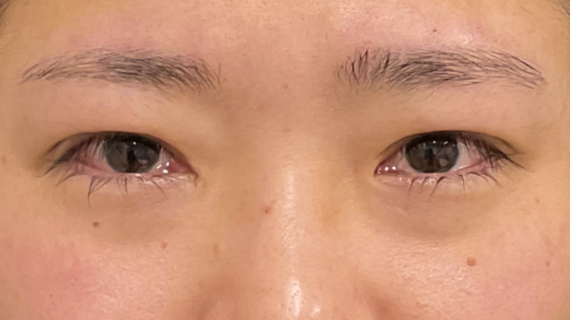 Postoperative Condition Part 1