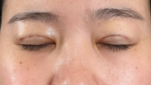 Postoperative Condition Part 1