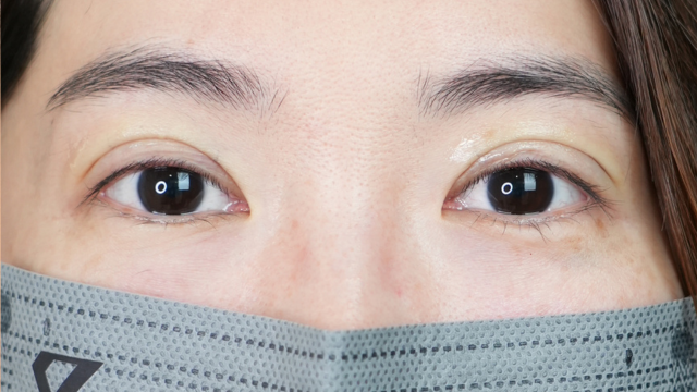 Postoperative Condition Part 1