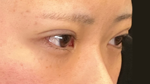 Postoperative Condition Part 1