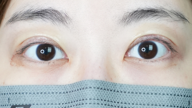 Postoperative Condition Part 1