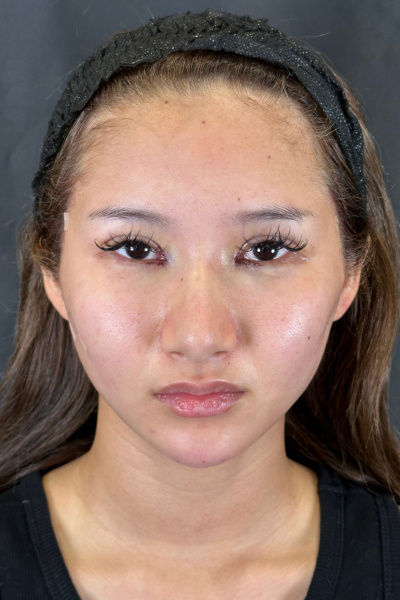 Postoperative Condition Part 1