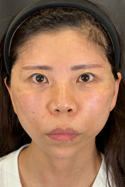 Postoperative Condition Part 1