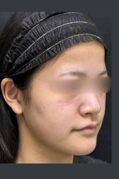 手術前の状態 その1