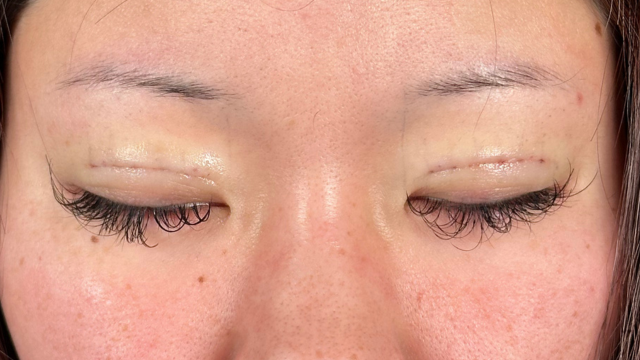 Postoperative Condition Part 1