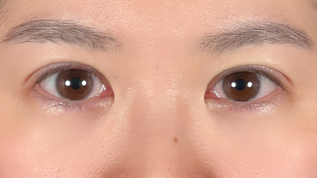 Postoperative Condition Part 1