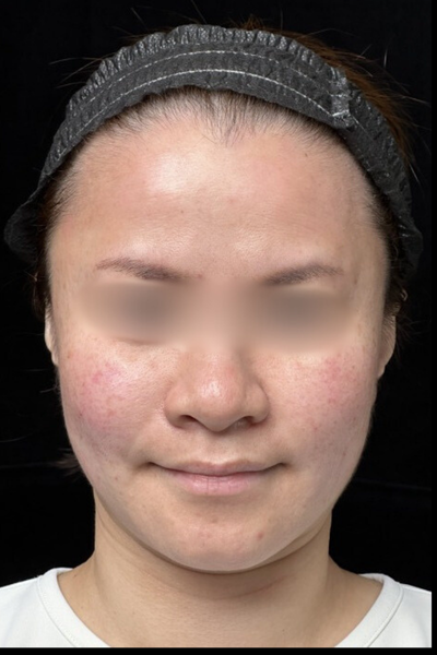 手術前の状態 その1