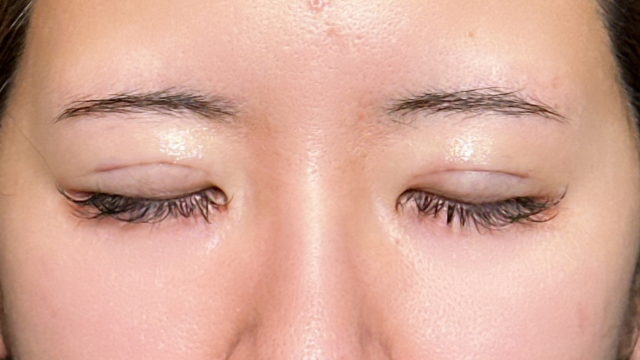 Postoperative Condition Part 1