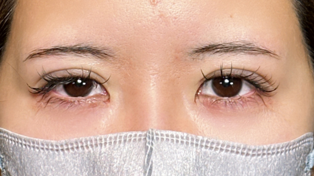 Postoperative Condition Part 1