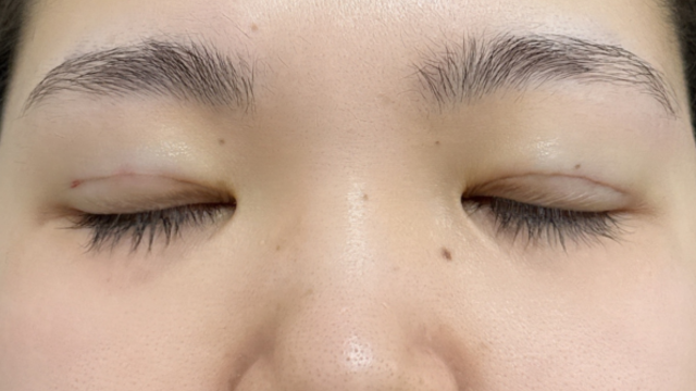 Postoperative Condition Part 1