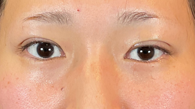 Postoperative Condition Part 1