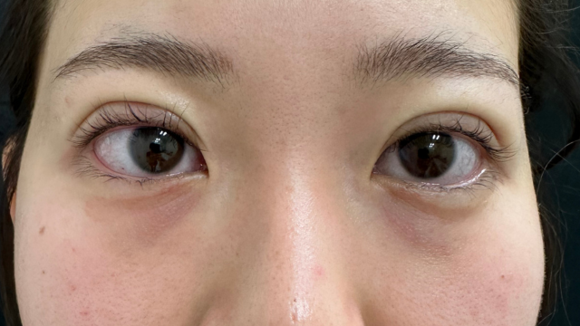 Postoperative Condition Part 1