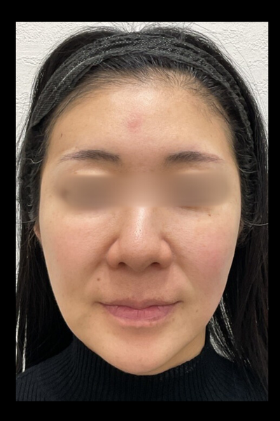 Postoperative Condition Part 1