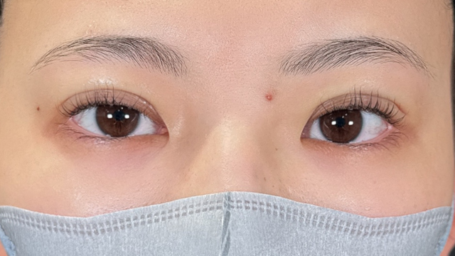 Postoperative Condition Part 1