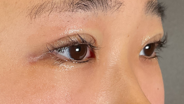 Postoperative Condition Part 1