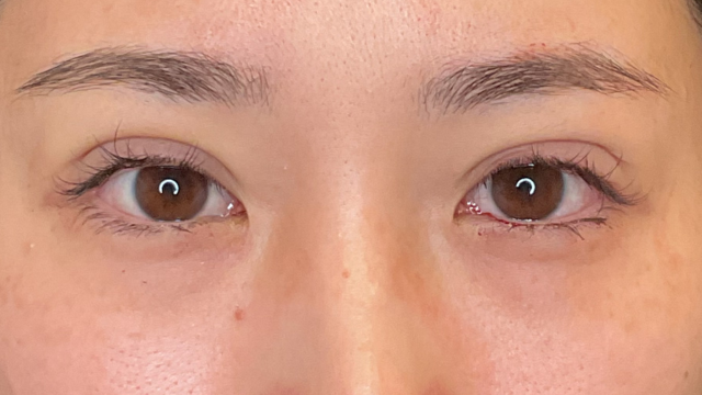 Postoperative Condition Part 1