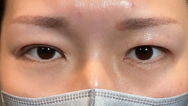 Postoperative Condition Part 1