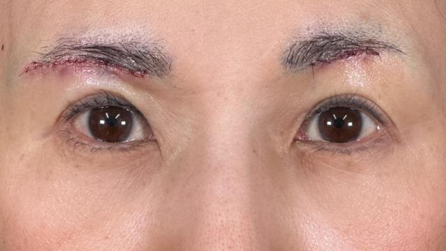 Postoperative Condition Part 1