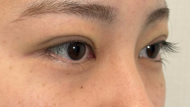 Postoperative Condition Part 1