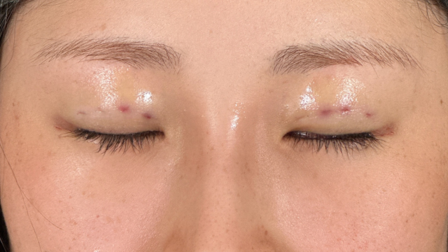 Postoperative Condition Part 1