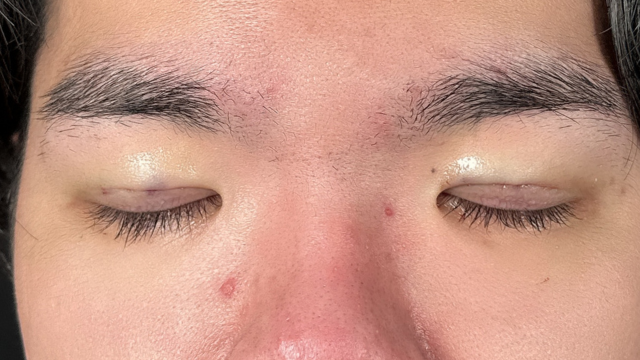 Postoperative Condition Part 1