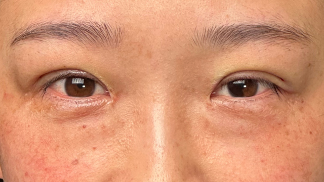 Postoperative Condition Part 1