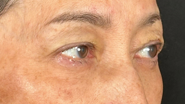 Postoperative Condition Part 1